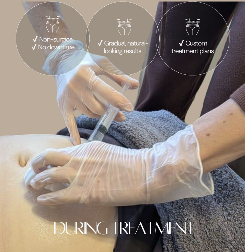Body treatment in progress - non-surgical, no downtime, gradual natural-looking results, custom treatment plans