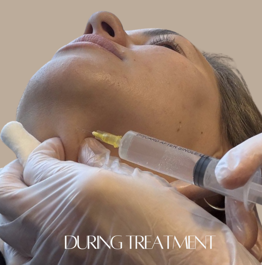 Nurse Vella delivering an aesthetic injectable treatment - hands-on, nurse-led clinical care